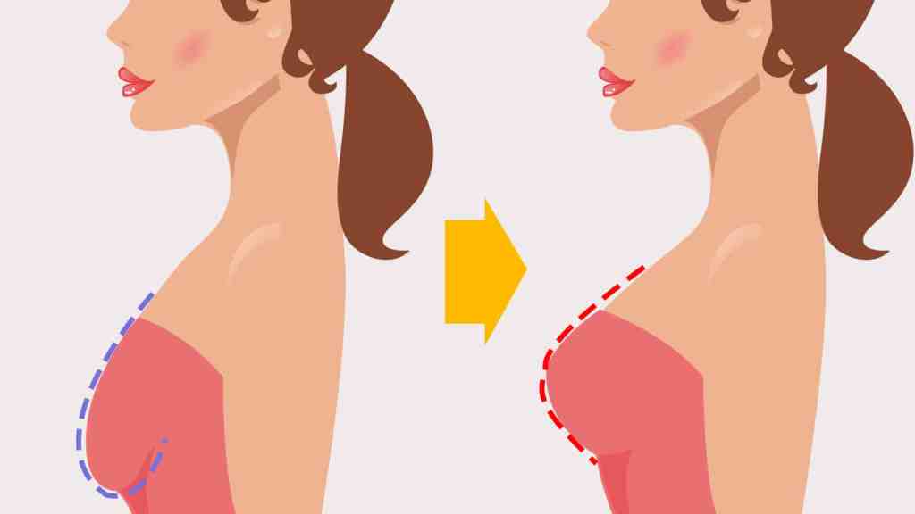 Top Non-Surgical Breast Lift Treatments to Consider